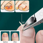 Pack Of 02 - NailCare Pro™ - Nail Cutter