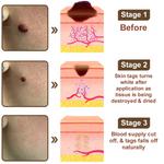 Pack Of  03 - Natravor® Black Rice Skin Repair Essence Cream⚕️ FDA Certified (Removes warts and skin growths, improves keratin buildup and seborrheic dermatitis, follicular keratosis, age spots, and bruising)