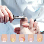 Pack Of 02 - NailCare Pro™ - Nail Cutter