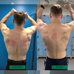 Pack Of 02 - Instant Posture Corrector